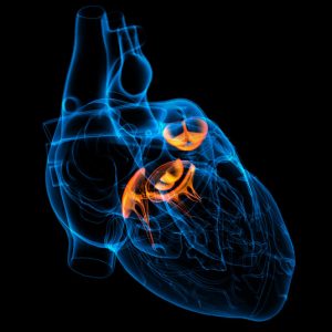 Beating Heart Aortic Valve Repair